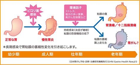 ピロリ菌
