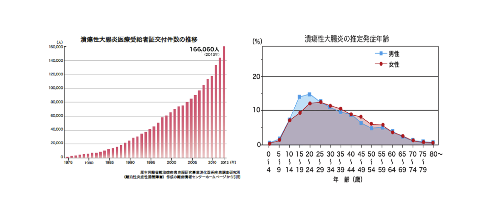 潰瘍性大腸炎