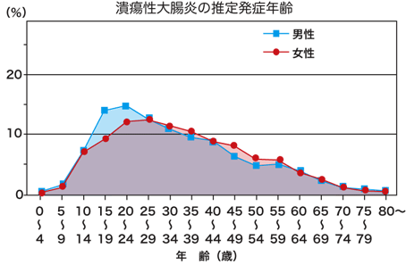 潰瘍性大腸炎