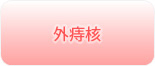 外痔核