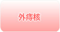 外痔核